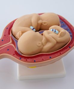 Uterul in perioada sarcinii 20