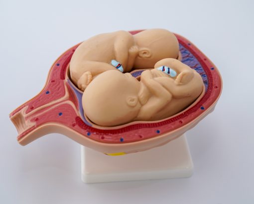 Uterul in perioada sarcinii 11