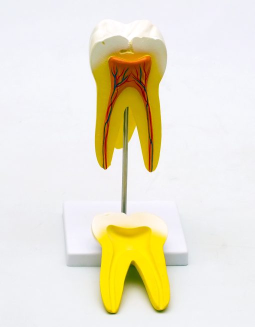 Model molar inferior cu radacina 3