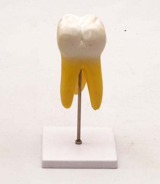 Model molar inferior cu radacina 5